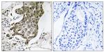 RABEP1 Antibody in Immunohistochemistry (Paraffin) (IHC (P))
