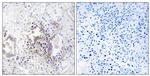 CHML Antibody in Immunohistochemistry (Paraffin) (IHC (P))