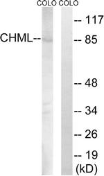 CHML Antibody in Western Blot (WB)