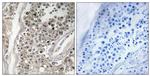 RAB3GAP1 Antibody in Immunohistochemistry (Paraffin) (IHC (P))
