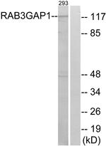 RAB3GAP1 Antibody in Western Blot (WB)
