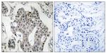 RAB3GAP2 Antibody in Immunohistochemistry (Paraffin) (IHC (P))