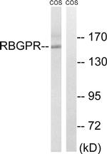 RAB3GAP2 Antibody in Western Blot (WB)