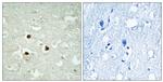 RAB3IP Antibody in Immunohistochemistry (Paraffin) (IHC (P))