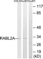 RABL2A Antibody in Western Blot (WB)