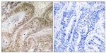 RDM1 Antibody in Immunohistochemistry (Paraffin) (IHC (P))