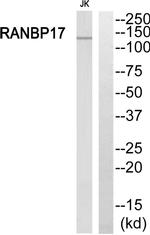RANBP17 Antibody in Western Blot (WB)