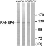 RANBP6 Antibody in Western Blot (WB)