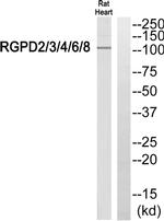 RGPD Pan Antibody in Western Blot (WB)