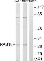 RAB18 Antibody in Western Blot (WB)