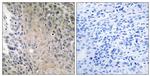 RAB41 Antibody in Immunohistochemistry (Paraffin) (IHC (P))