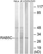 RAB5C Antibody in Western Blot (WB)