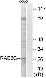 RAB6C Antibody in Western Blot (WB)