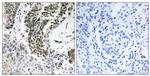 RREB1 Antibody in Immunohistochemistry (Paraffin) (IHC (P))
