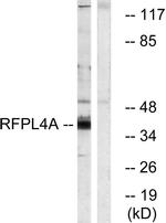 RFPL4A Antibody in Western Blot (WB)