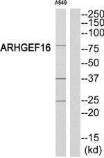 ARHGEF16 Antibody in Western Blot (WB)