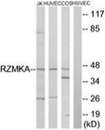 RIMKLA Antibody in Western Blot (WB)