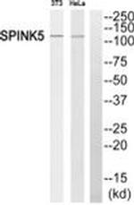 SPINK5 Antibody in Western Blot (WB)