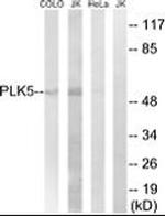 PLK5 Antibody in Western Blot (WB)