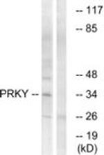 PRKY Antibody in Western Blot (WB)