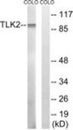 TLK2 Antibody in Western Blot (WB)