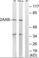 PPP2R1B Antibody in Western Blot (WB)