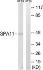 SERPINA11 Antibody in Western Blot (WB)