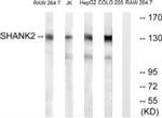 SHANK2 Antibody in Western Blot (WB)