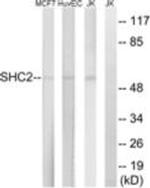 SCK Antibody in Western Blot (WB)