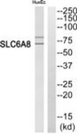 SLC6A8 Antibody in Western Blot (WB)