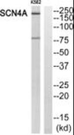 SCN4A Antibody in Western Blot (WB)