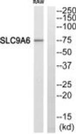 SLC9A6 Antibody in Western Blot (WB)