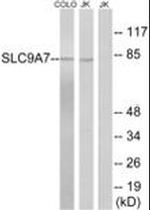 SLC9A7 Antibody in Western Blot (WB)