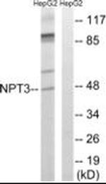 SLC17A2 Antibody in Western Blot (WB)