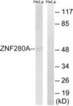ZNF280A Antibody in Western Blot (WB)