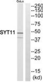 SYT11 Antibody in Western Blot (WB)