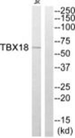 TBX18 Antibody in Western Blot (WB)