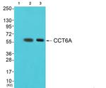 TCP-1 zeta Antibody in Western Blot (WB)
