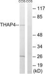 THAP4 Antibody in Western Blot (WB)
