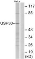 USP30 Antibody in Western Blot (WB)