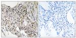 UEVLD Antibody in Immunohistochemistry (Paraffin) (IHC (P))