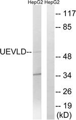 UEVLD Antibody in Western Blot (WB)