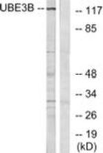 UBE3B Antibody in Western Blot (WB)