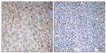 WAVE2 Antibody in Immunohistochemistry (Paraffin) (IHC (P))