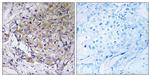 WASF3 Antibody in Immunohistochemistry (Paraffin) (IHC (P))