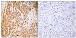 ZNF50 Antibody in Immunohistochemistry (Paraffin) (IHC (P))
