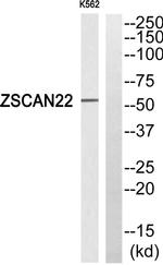 ZNF50 Antibody in Western Blot (WB)