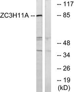 ZC3H11A Antibody in Western Blot (WB)
