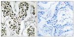 ZC3H4 Antibody in Immunohistochemistry (Paraffin) (IHC (P))