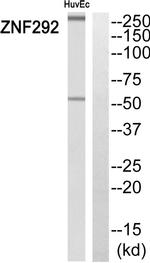 ZNF292 Antibody in Western Blot (WB)